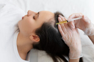 female hair transplant